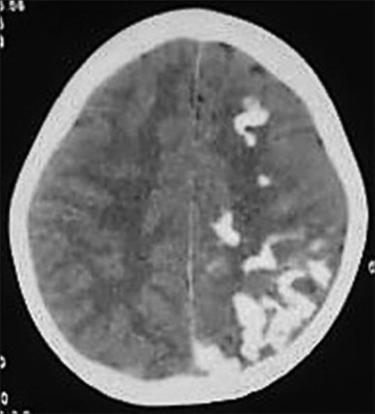 https://cdn.ncbi.nlm.nih.gov/pmc/blobs/4eb2/7546286/17c098b3993e/IJRI-30-195-g016.jpg