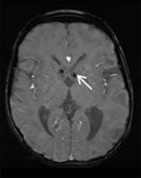 https://cdn.ncbi.nlm.nih.gov/pmc/blobs/4eb2/7546286/21f4b73a8ea2/IJRI-30-195-g013.jpg