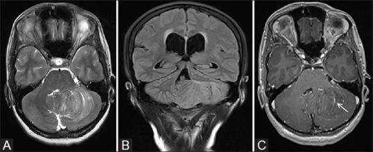 https://cdn.ncbi.nlm.nih.gov/pmc/blobs/4eb2/7546286/284f8411a894/IJRI-30-195-g025.jpg