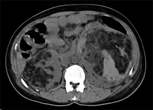 https://cdn.ncbi.nlm.nih.gov/pmc/blobs/4eb2/7546286/43d71ccaa043/IJRI-30-195-g015.jpg
