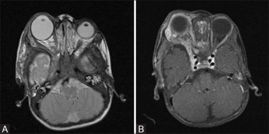 https://cdn.ncbi.nlm.nih.gov/pmc/blobs/4eb2/7546286/6667885c166f/IJRI-30-195-g004.jpg