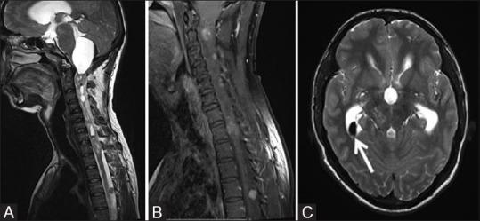 https://cdn.ncbi.nlm.nih.gov/pmc/blobs/4eb2/7546286/beaf95ef0e70/IJRI-30-195-g010.jpg