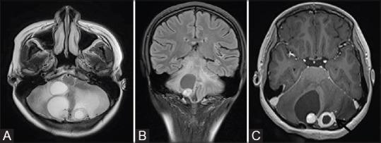 https://cdn.ncbi.nlm.nih.gov/pmc/blobs/4eb2/7546286/c740857f89c7/IJRI-30-195-g018.jpg