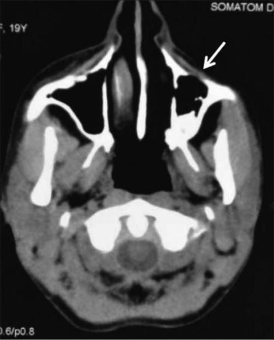 https://cdn.ncbi.nlm.nih.gov/pmc/blobs/4eb2/7546286/cb3ec089494b/IJRI-30-195-g024.jpg