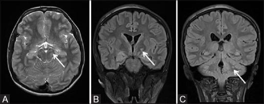 https://cdn.ncbi.nlm.nih.gov/pmc/blobs/4eb2/7546286/e366967e3d3f/IJRI-30-195-g003.jpg