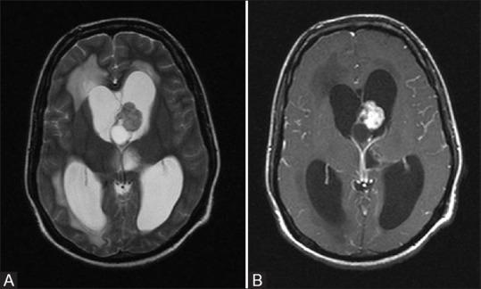 https://cdn.ncbi.nlm.nih.gov/pmc/blobs/4eb2/7546286/e3a4c8629b5e/IJRI-30-195-g014.jpg