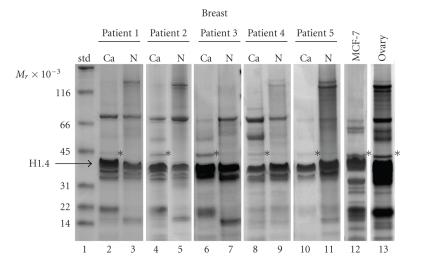 https://cdn.ncbi.nlm.nih.gov/pmc/blobs/4eb7/2801467/5c32a485e91a/JBB2009-919645.001.jpg