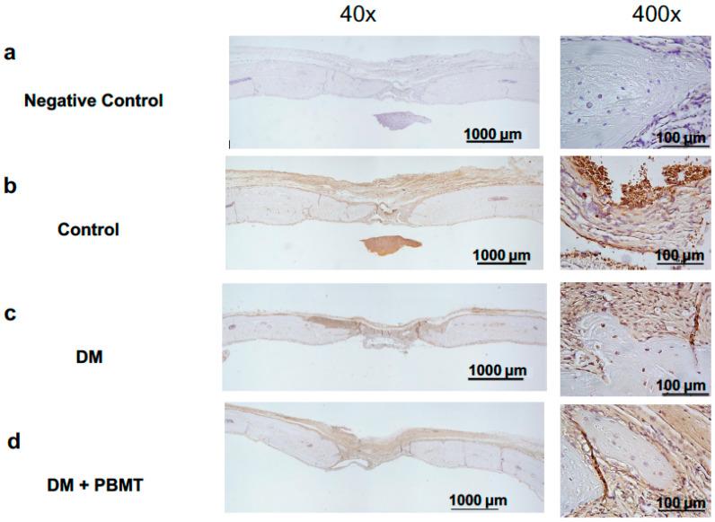 https://cdn.ncbi.nlm.nih.gov/pmc/blobs/4eba/8541159/f05afe941424/ijms-22-11026-g004.jpg