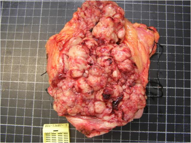 https://cdn.ncbi.nlm.nih.gov/pmc/blobs/4ebb/5477964/9aeb27346795/sfq042fig2.jpg