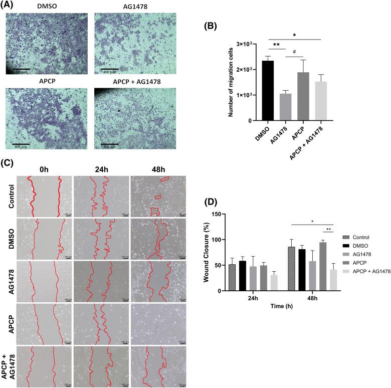 https://cdn.ncbi.nlm.nih.gov/pmc/blobs/4ebc/11964884/c4459825dd23/OncolRes-33-55508-f006.jpg