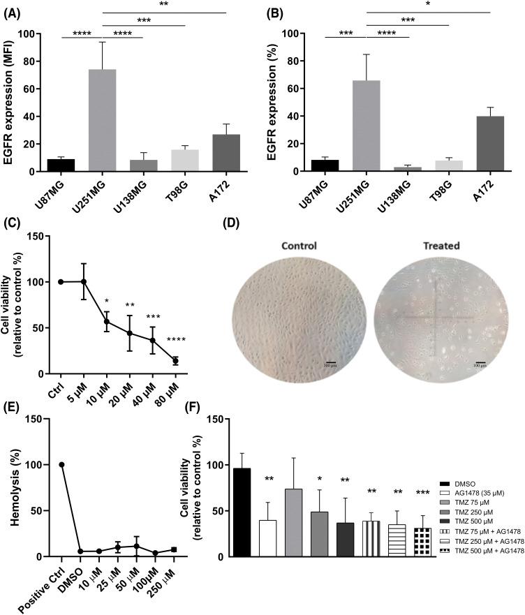 https://cdn.ncbi.nlm.nih.gov/pmc/blobs/4ebc/11964884/dbdba400b79f/OncolRes-33-55508-f001.jpg
