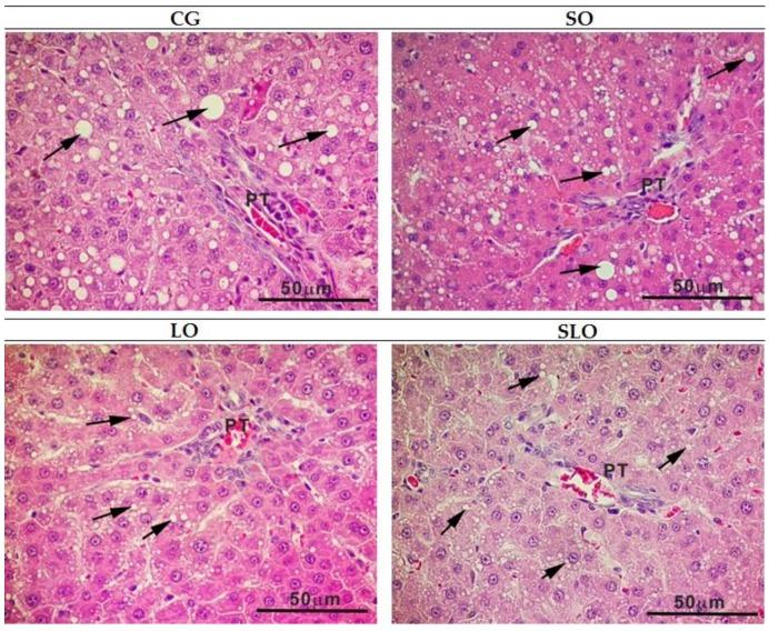 https://cdn.ncbi.nlm.nih.gov/pmc/blobs/4ec1/7019636/4874c2a46608/nutrients-12-00009-g006.jpg