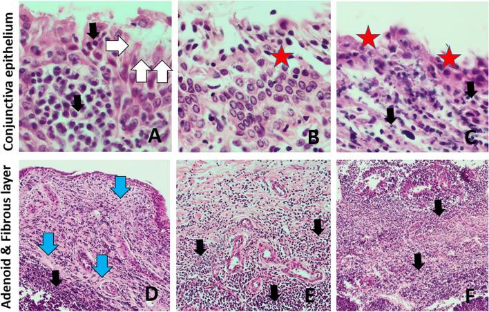 https://cdn.ncbi.nlm.nih.gov/pmc/blobs/4ec4/11580673/cd6b6b80651d/12917_2024_4375_Fig5_HTML.jpg