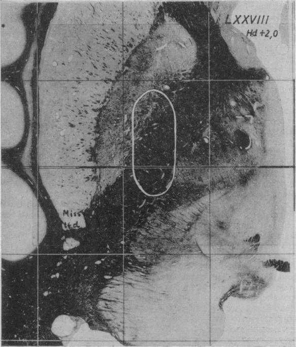 https://cdn.ncbi.nlm.nih.gov/pmc/blobs/4ec5/1869565/692de6a0ab93/procrsmed00245-0057-a.jpg