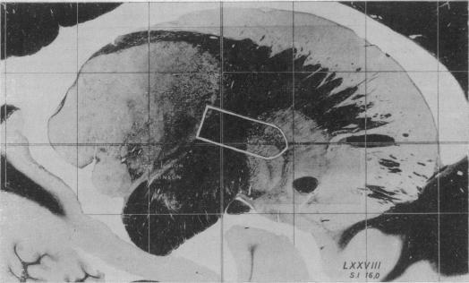 https://cdn.ncbi.nlm.nih.gov/pmc/blobs/4ec5/1869565/b92a37c21765/procrsmed00245-0056-b.jpg
