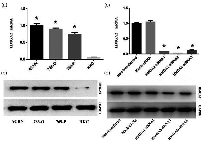 https://cdn.ncbi.nlm.nih.gov/pmc/blobs/4eca/8819771/5786766c36ae/10.1177_03000605221075511-fig1.jpg