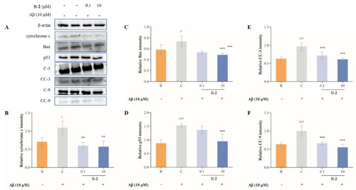 https://cdn.ncbi.nlm.nih.gov/pmc/blobs/4ecf/9866346/f0c91fc98ed6/ijms-24-00905-g007.jpg