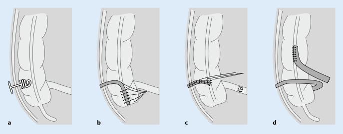 https://cdn.ncbi.nlm.nih.gov/pmc/blobs/4ed2/8159781/48514cc9eb9a/104_2021_1364_Fig1_HTML.jpg