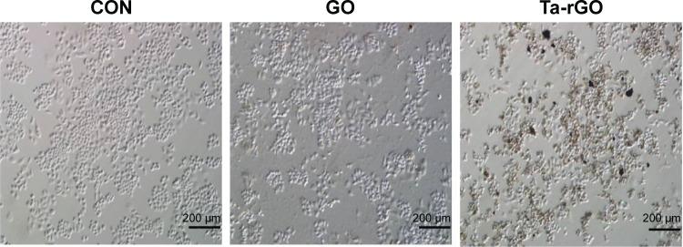 https://cdn.ncbi.nlm.nih.gov/pmc/blobs/4ed5/4863686/40fba8e69c83/ijn-11-1927Fig2.jpg