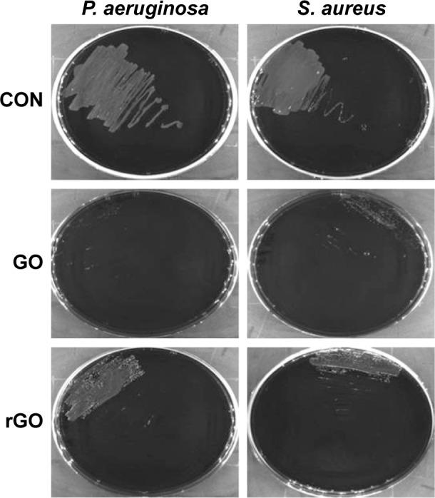 https://cdn.ncbi.nlm.nih.gov/pmc/blobs/4ed5/4863686/5dd33f62b6c9/ijn-11-1927Fig1.jpg