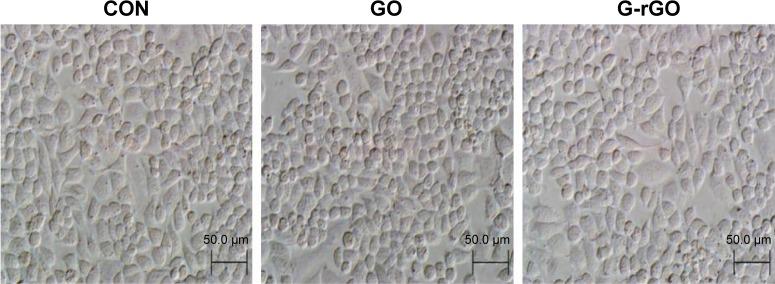 https://cdn.ncbi.nlm.nih.gov/pmc/blobs/4ed5/4863686/a108bac0dfc3/ijn-11-1927Fig3.jpg