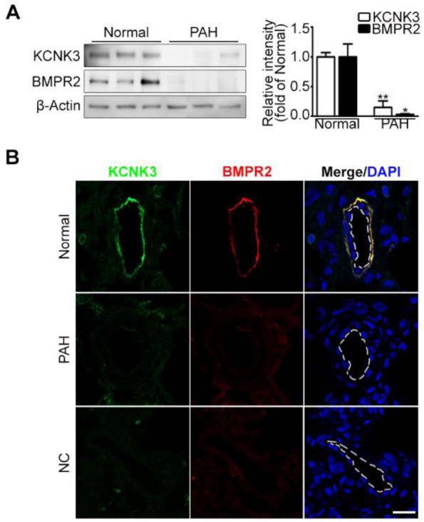 https://cdn.ncbi.nlm.nih.gov/pmc/blobs/4ed6/9712703/195741feb709/bmb-55-11-565-f1.jpg