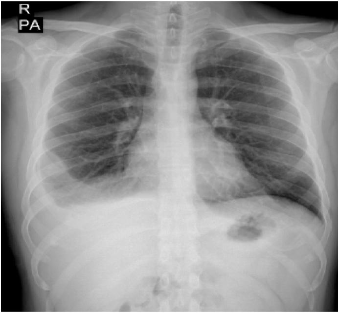 https://cdn.ncbi.nlm.nih.gov/pmc/blobs/4edb/10806747/ab4a47bb2f66/gr2.jpg