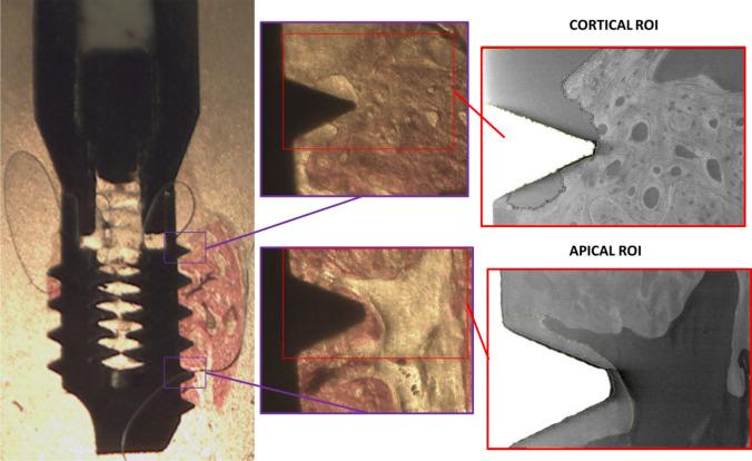 https://cdn.ncbi.nlm.nih.gov/pmc/blobs/4edc/11144681/70566205f66b/10006_2023_1175_Fig1_HTML.jpg