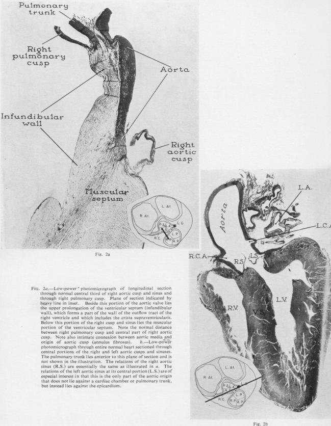 https://cdn.ncbi.nlm.nih.gov/pmc/blobs/4ede/1019237/48d2d619cfd5/thorax00046-0048-a.jpg