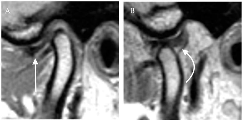 https://cdn.ncbi.nlm.nih.gov/pmc/blobs/4ee0/9031630/694bb2ecd05f/diagnostics-12-01006-g004.jpg