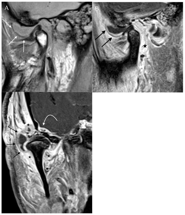 https://cdn.ncbi.nlm.nih.gov/pmc/blobs/4ee0/9031630/7c1eff6943bc/diagnostics-12-01006-g007.jpg