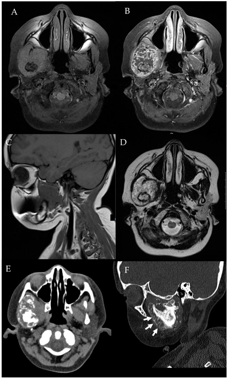 https://cdn.ncbi.nlm.nih.gov/pmc/blobs/4ee0/9031630/97ff038e47ba/diagnostics-12-01006-g011.jpg