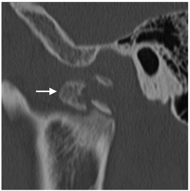 https://cdn.ncbi.nlm.nih.gov/pmc/blobs/4ee0/9031630/b43609bcc218/diagnostics-12-01006-g008.jpg
