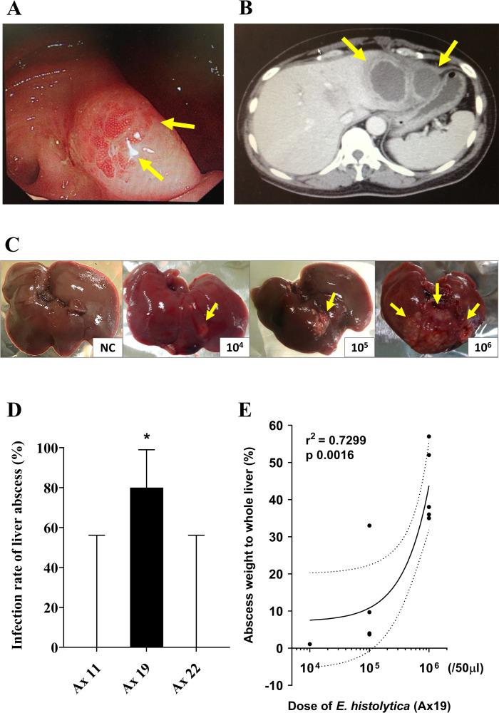 https://cdn.ncbi.nlm.nih.gov/pmc/blobs/4ee2/9555656/1e5b183fb34d/ppat.1010880.g001.jpg