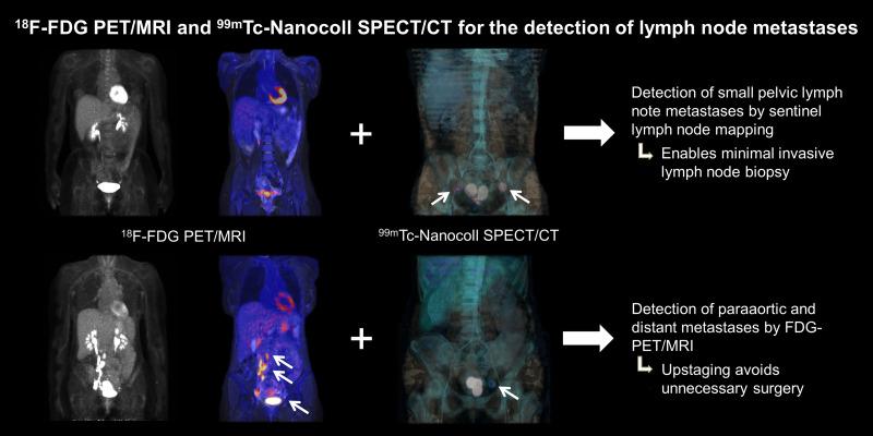 https://cdn.ncbi.nlm.nih.gov/pmc/blobs/4ee4/8833872/e41c2a8694be/jnm255919absf1.jpg