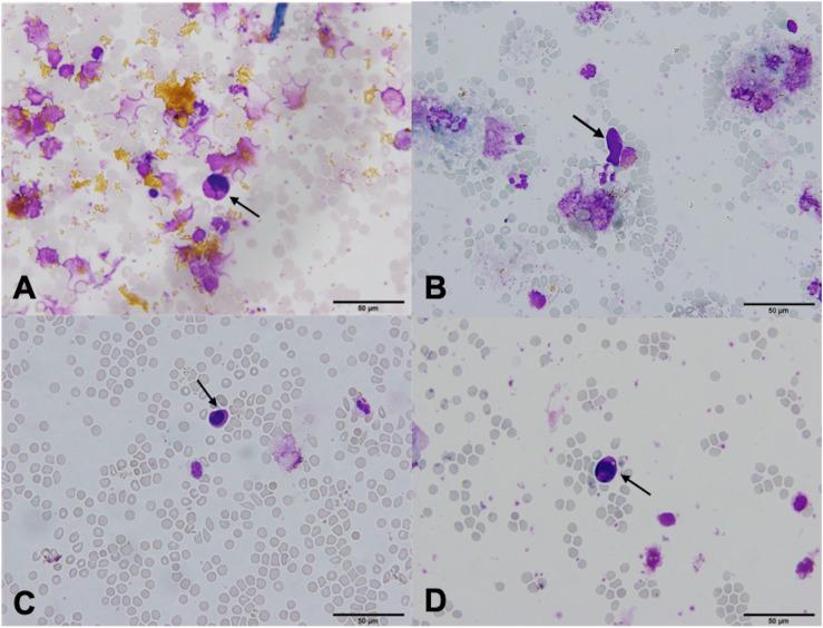 https://cdn.ncbi.nlm.nih.gov/pmc/blobs/4eea/7522616/08195a0b1d6c/fonc-10-554554-g005.jpg
