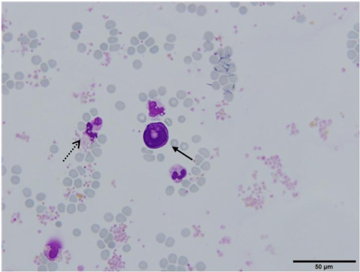 https://cdn.ncbi.nlm.nih.gov/pmc/blobs/4eea/7522616/55ad91ca4fda/fonc-10-554554-g004.jpg