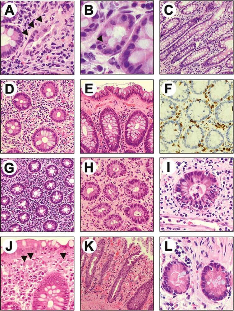 https://cdn.ncbi.nlm.nih.gov/pmc/blobs/4eeb/10769780/5a726a54ffa9/oyad238_fig3.jpg