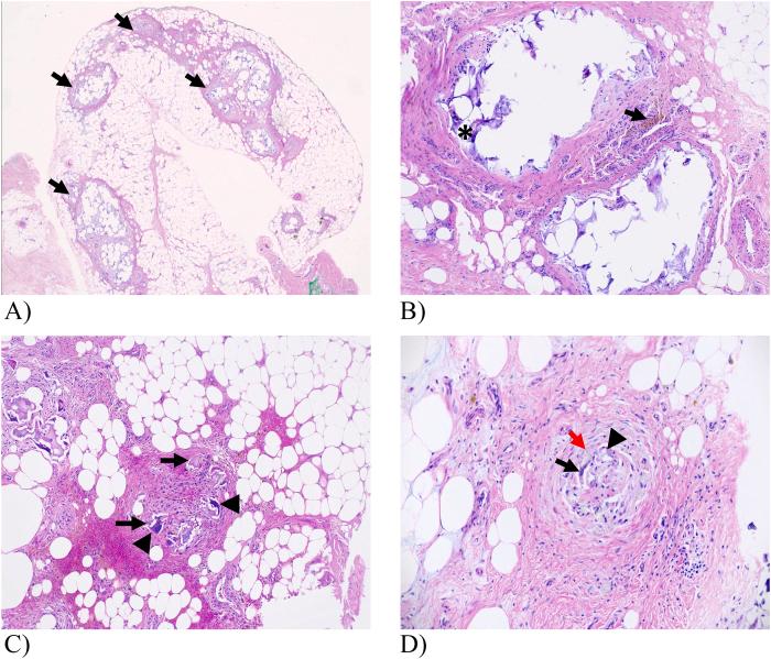 https://cdn.ncbi.nlm.nih.gov/pmc/blobs/4eeb/8968009/23e413747fa8/gr2.jpg