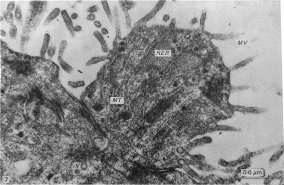 https://cdn.ncbi.nlm.nih.gov/pmc/blobs/4ef2/1233028/60c70c30180c/janat00239-0176-a.jpg