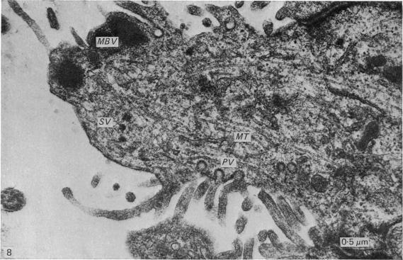 https://cdn.ncbi.nlm.nih.gov/pmc/blobs/4ef2/1233028/dd8dfaeeea6a/janat00239-0176-b.jpg