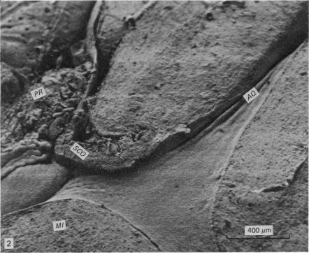 https://cdn.ncbi.nlm.nih.gov/pmc/blobs/4ef2/1233028/ff5e52d566d8/janat00239-0173-b.jpg
