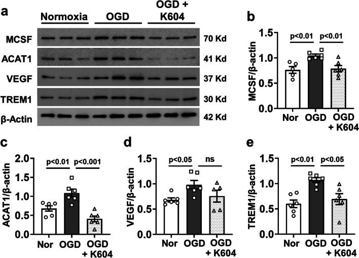 https://cdn.ncbi.nlm.nih.gov/pmc/blobs/4ef7/9869542/2764a44fc946/12974_2023_2700_Fig10_HTML.jpg