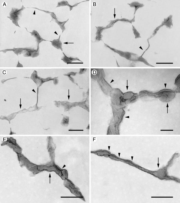 https://cdn.ncbi.nlm.nih.gov/pmc/blobs/4ef8/2697165/7292b7a116ad/1471-2180-9-103-3.jpg
