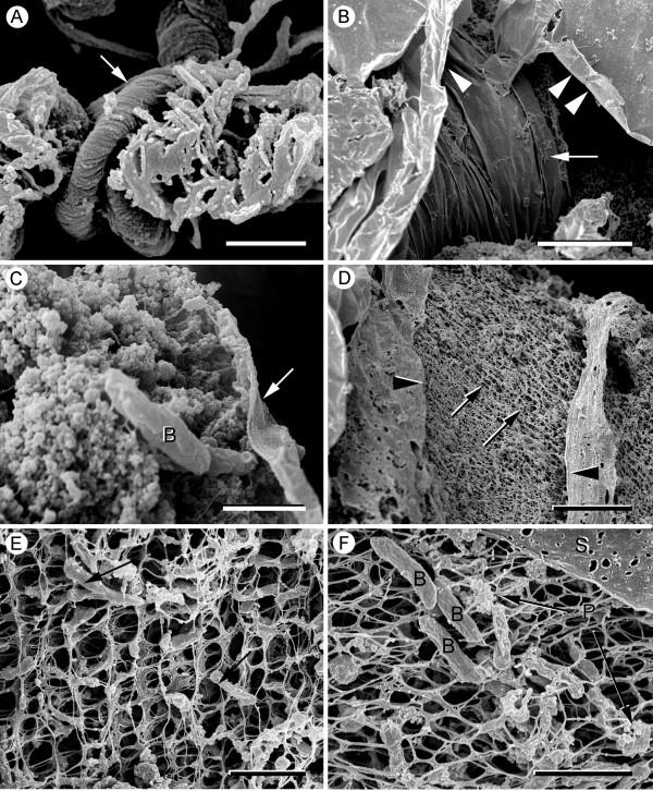 https://cdn.ncbi.nlm.nih.gov/pmc/blobs/4ef8/2697165/9bf08aea302a/1471-2180-9-103-2.jpg