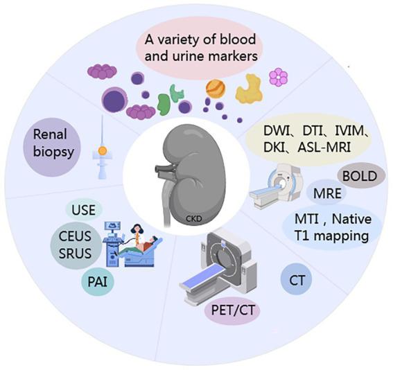 https://cdn.ncbi.nlm.nih.gov/pmc/blobs/4ef9/12343605/54e9f9f58954/fmed-12-1646412-g002.jpg