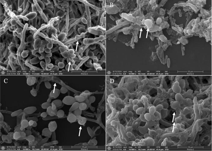 https://cdn.ncbi.nlm.nih.gov/pmc/blobs/4efb/12059863/b9f76cf0c20d/NarraJ-5-e1714-g004.jpg