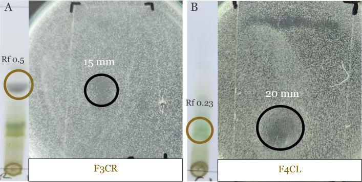 https://cdn.ncbi.nlm.nih.gov/pmc/blobs/4efb/12059863/d62e928ba3cf/NarraJ-5-e1714-g002.jpg