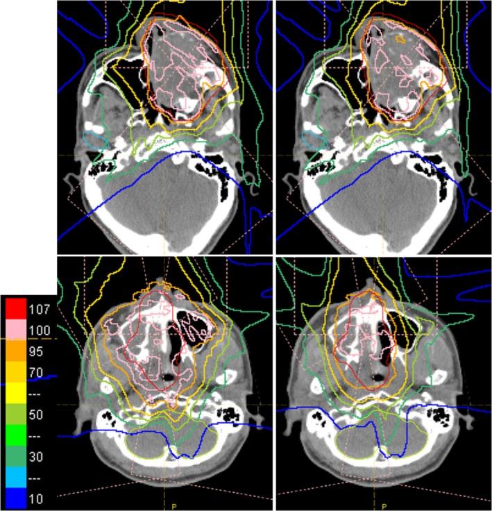 https://cdn.ncbi.nlm.nih.gov/pmc/blobs/4efb/5768032/8140ae1606b4/ACM2-19-132-g004.jpg