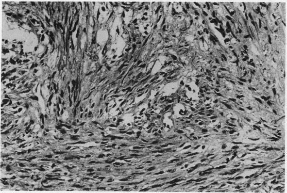 https://cdn.ncbi.nlm.nih.gov/pmc/blobs/4efd/460697/28497da35378/thorax00256-0023-a.jpg